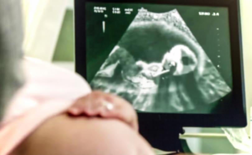 Relação casual acabou em gravidez, mas ela desistiu do aborto após ecografia